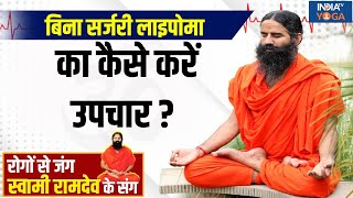 YOGA LIVE: बिना सर्जरी लाइपोमा का कैसे करें उपचार ? जानें Swami Ramdev से  | Yoga Tips | Lipoma