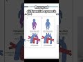 Reversed differential cyanosis #nicu