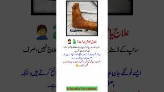 Snake Bite Treatment or Dangerous Myth? 🐍⚠️ | Public Awareness Message