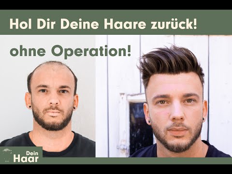 Dein Haar - Hol es Dir zurück - Volles Haar, ohne Operation. Das Haarsystem für zuhause.