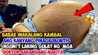 BABAENG INAKALANG KAMBAL ANG KANYANG IPINAGBUBUNTIS LAKING GULAT NG MGA DOKTOR SA KANILANG NAKITA