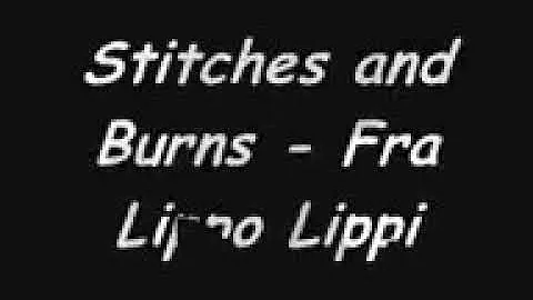 Stitches and buRns