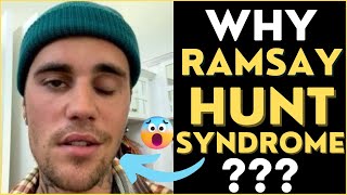 Why JUSTIN BIEBER got Ramsay Hunt Syndrome? (3D Animation) #shorts