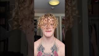 Rapaz Sem Clavícula Impressiona Ao Usar Ombros Para Bater Palmas