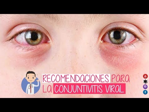 Vídeo: Conjuntivitis Viral: Causas, Tipos, Síntomas, Tratamiento, Prevención