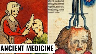 15 Most Dangerous Medical Practices of Antiquity