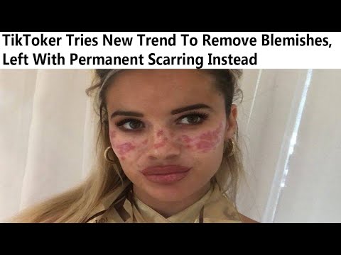 r/FacePalms | TikTok Perfect Skin Trend Ruining Skin Instead