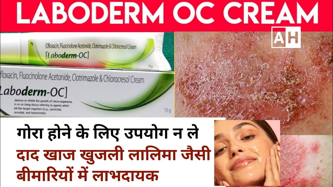 Haw to use Labodarm OC Cream. Cream Review. लेबोडर्म क्रीम के फायदे ...