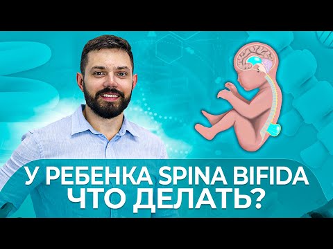 Spina Bifida: Что