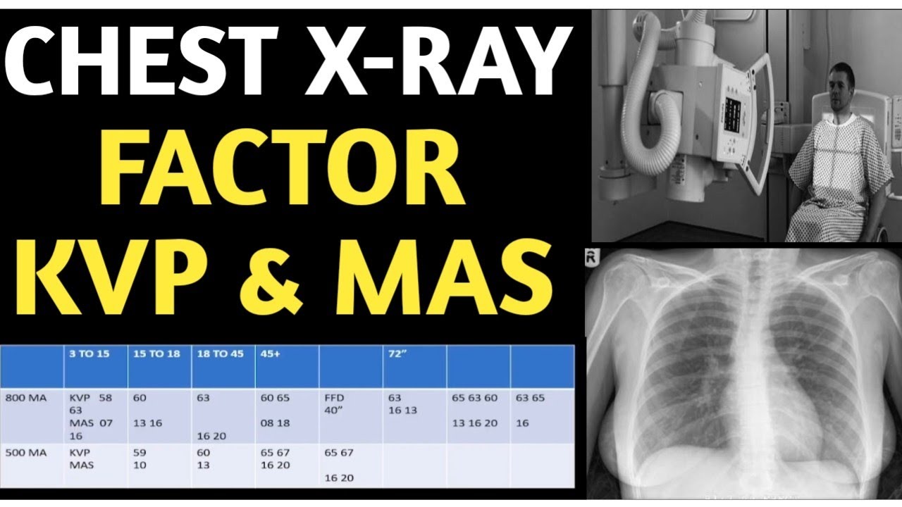 Chest X ray Factor Factor Chest x Ray Kvp And Mas 