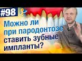 Имплантация при пародонтозе. Можно ли ставить импланты если был пародонтоз?