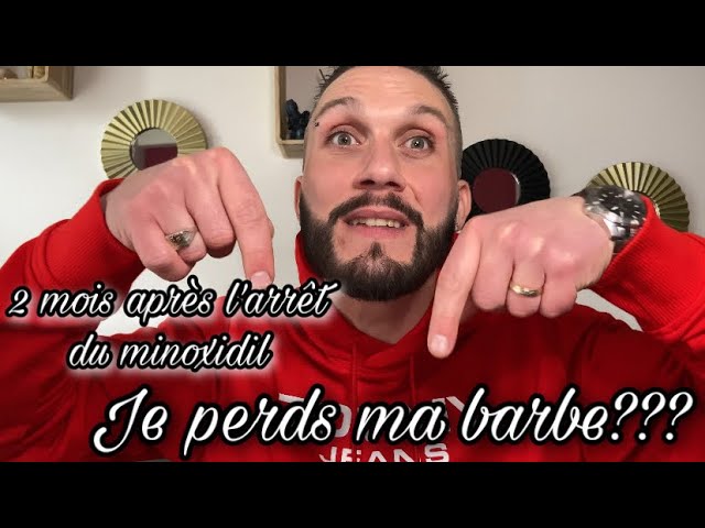 Je vous dis tout!!!1 mois après l'arrêt du minoxidil!!! - YouTube