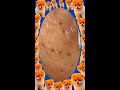 Blackheads Removal | Acne Treatment and Very Satisfying Satisfying Pimple pop #blackheads