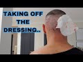 HAIR TRANSPLANT - Days 2-4 | How to take off the dressing correctly!!