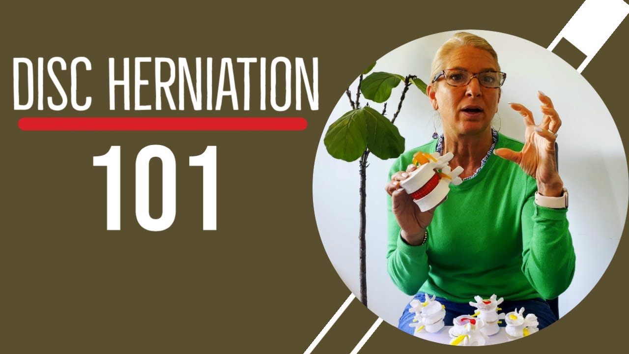 Disc Herniation 101 | Chiropractor for Disc Injuries in Belmar, NJ