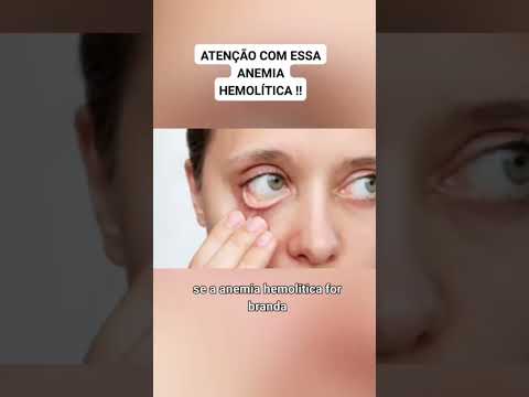 Anemia( Quais as causas) #shorts #cuidados #saude #anemia