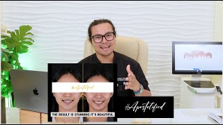 Destroyed to Restored Smile | Veneers, Crowns and Fixed Bridge | Apostol Dental Philippines