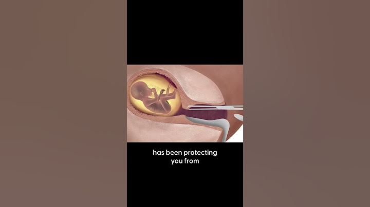 Abortion Is Not A Valid Choice - Killing A Child Is Wrong