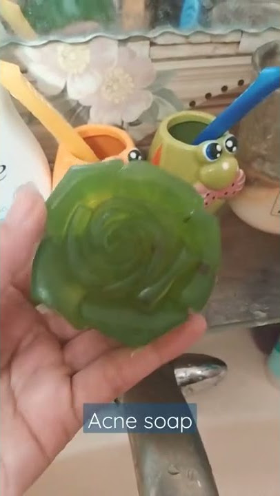 Download lagu i ordered from slaynshop #acne #acnetreatment #antiacne #acnescars