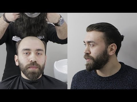 PROTEZ SAÇ BAĞLAMA MODELİ - Hair Replacement