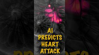 AI Predicts Heart Attack