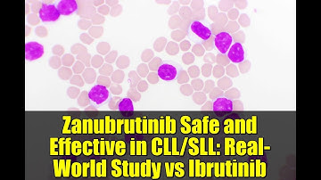 Zanubrutinib Safe and Effective in CLL/SLL: Real-World Study vs Ibrutinib