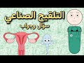 التلقيح الصناعي داخل الرحم سؤال وجواب 