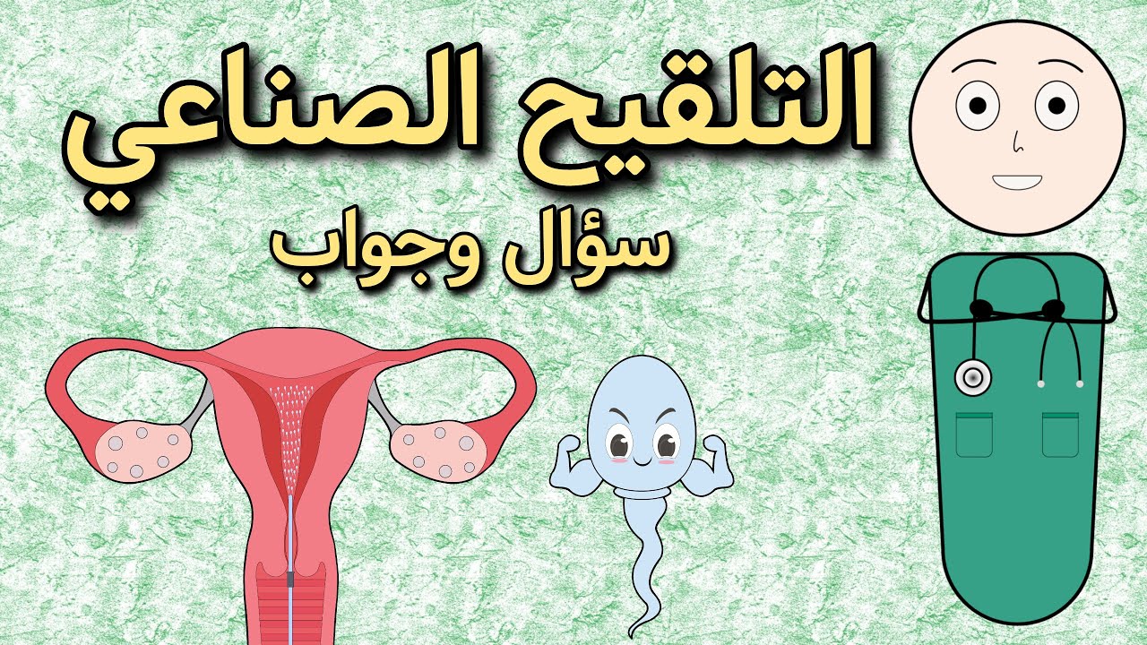 التلقيح الصناعي داخل الرحم - سؤال وجواب