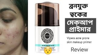 acne prone skin vipera
