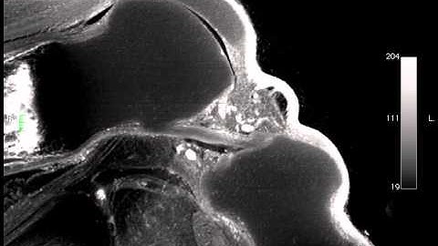 E20 Rat Knee joint with EFIC