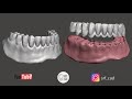Meshmixer  dental   come separare placca e denti da una protesi mobile monolitica ptm full denture