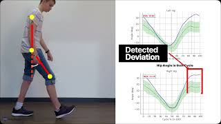 FlexiGait  - #Abnormal Gait - Subject 1