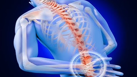 Bị đau lưng, phát hiện thận ứ nước | CDT NEWS