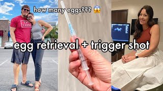 EGG RETRIEVAL PREP Trigger Shot, Retrieval Day + How Many Eggs  *IVF Week 2 (*ICSI Week 2)