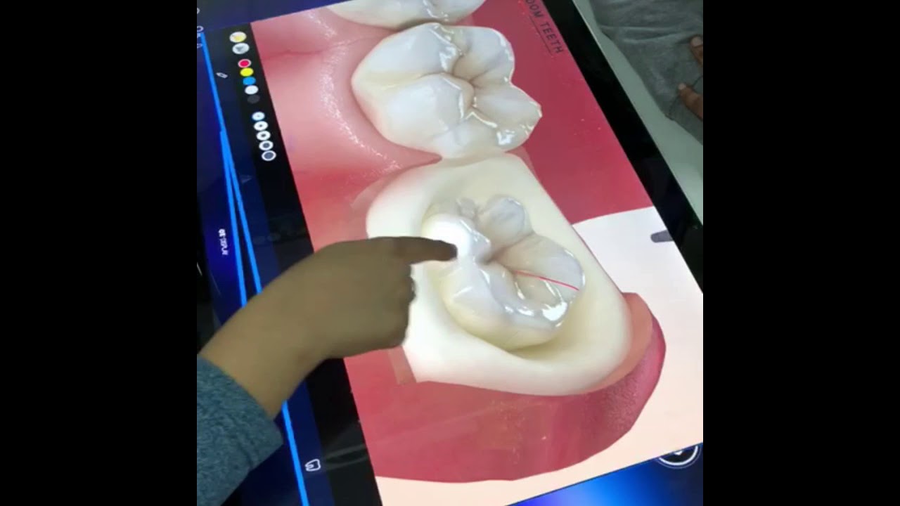 Digital Smart Clinic Chandigarh, Mohali and Panchkula Second