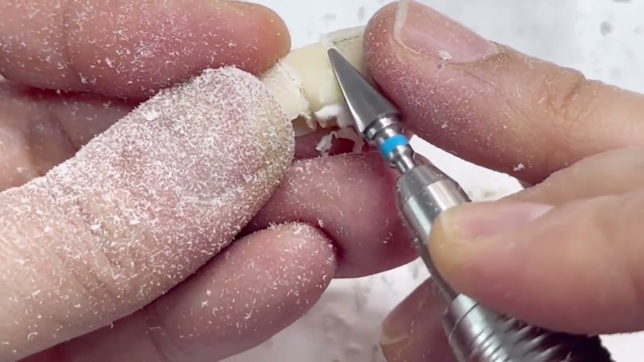 임플란트 커스텀어버트먼트 임시치아 (6전치 br)