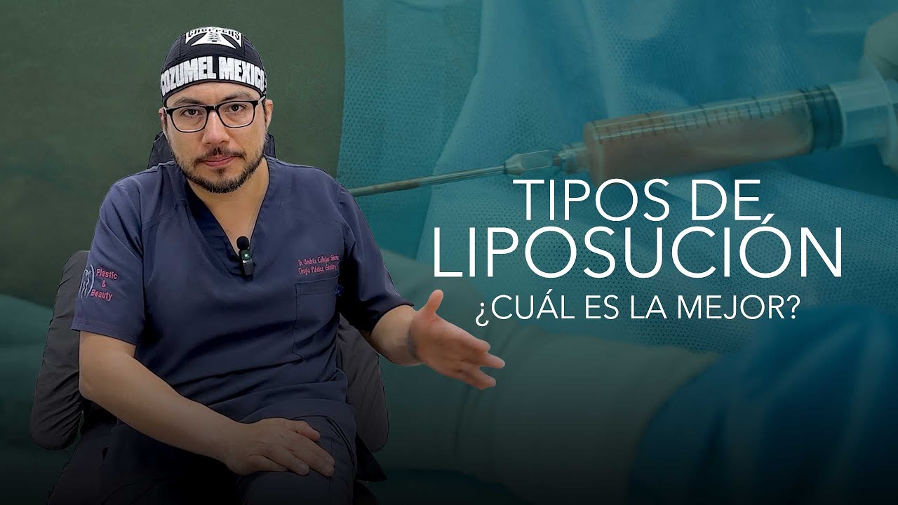 ¿Cuál es la mejor opción para realizarse una Lipo?.  Tipos de Liposucción.