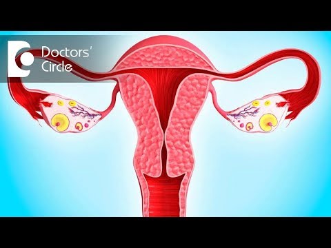 Can Polycystic Ovaries cause high prolactin & androgen levels? - Dr. Anjana Ramesh