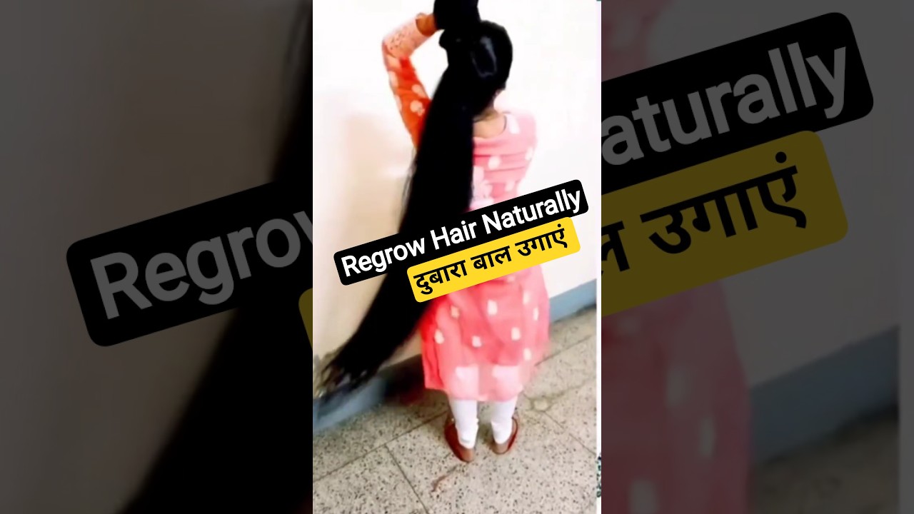 Dubara Baal Ugaye! 😱 Ganjapan Aur Hair Fall Ka Powerful Gharelu Nuskha