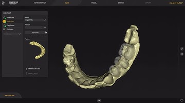 1 on 1 copy in de inLab 22 software