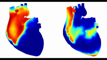 Whole-heart modeling and simulation - Electrical Wave Conduction and Propagation