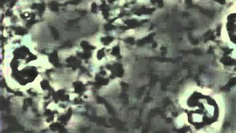 Spirochetes under phase contrast microscope