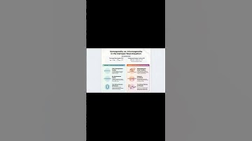 Plucking the string forces dynamic motion