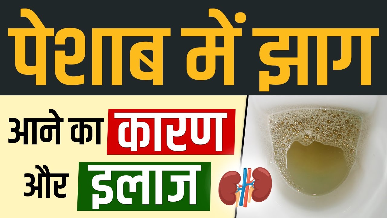 पेशाब में झाग आने का कारण और इलाज Urine me jhag aane ka karan Peshab