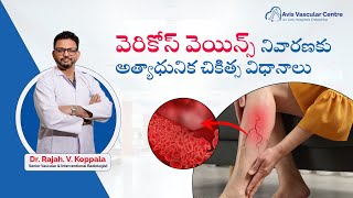 The different treatment options for varicose veins explained by Dr Rajah V Koppala