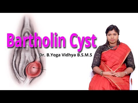 பார்தோலின் நீர்க்கட்டி | Bartholin Cyst Causes - Ethnic Health Care - Dr. B.Yoga Vidhya (2018)