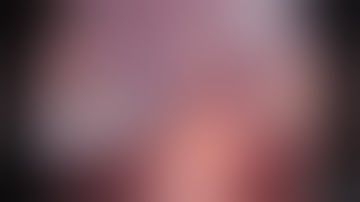 VATS Resection for Extralobar Pulmonary Sequestration