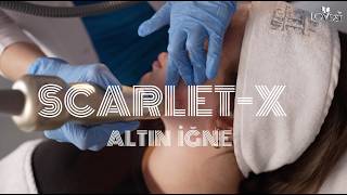 Scarlet-X ile Cilt Yenileme | Altın İğne Teknolojisi #scarletx