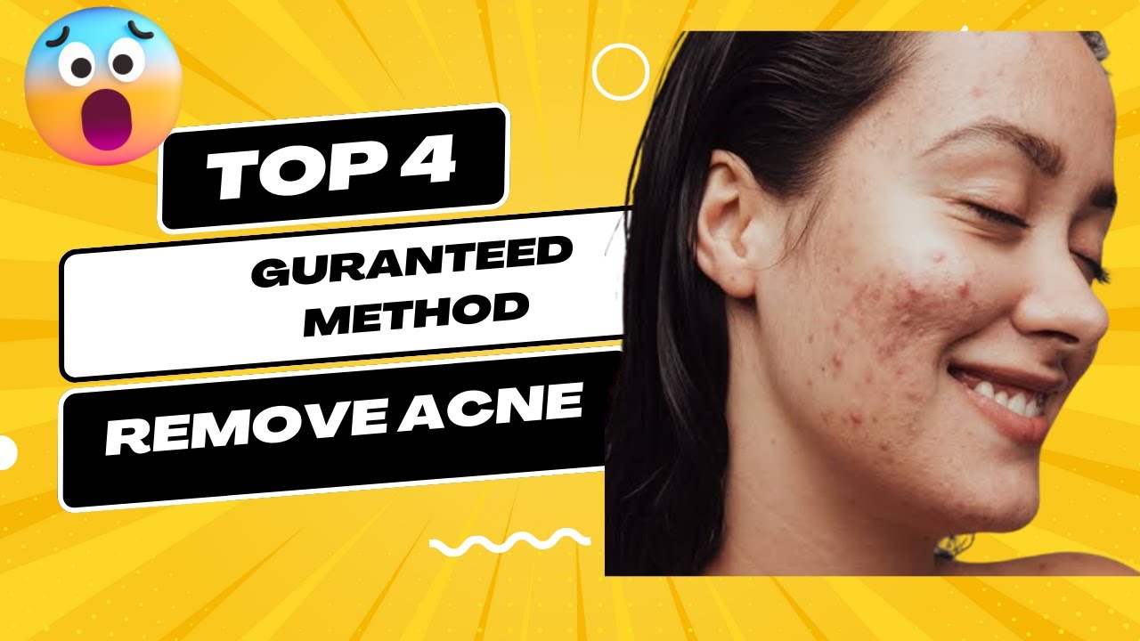 How to Remove Acne Dark Spots Dry Skin 4 Proven Methods Revelead YouTube
