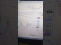 Tranding Share Market Short Video |Short Video Share Market| #sharemarket